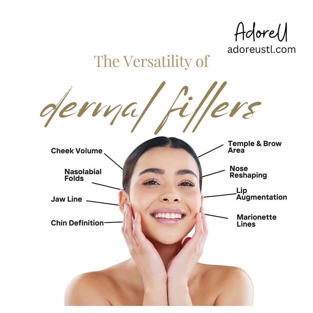 dermal fillers