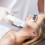 Unlock radiant skin with photofacial and laser treatments in St. Peters, MO