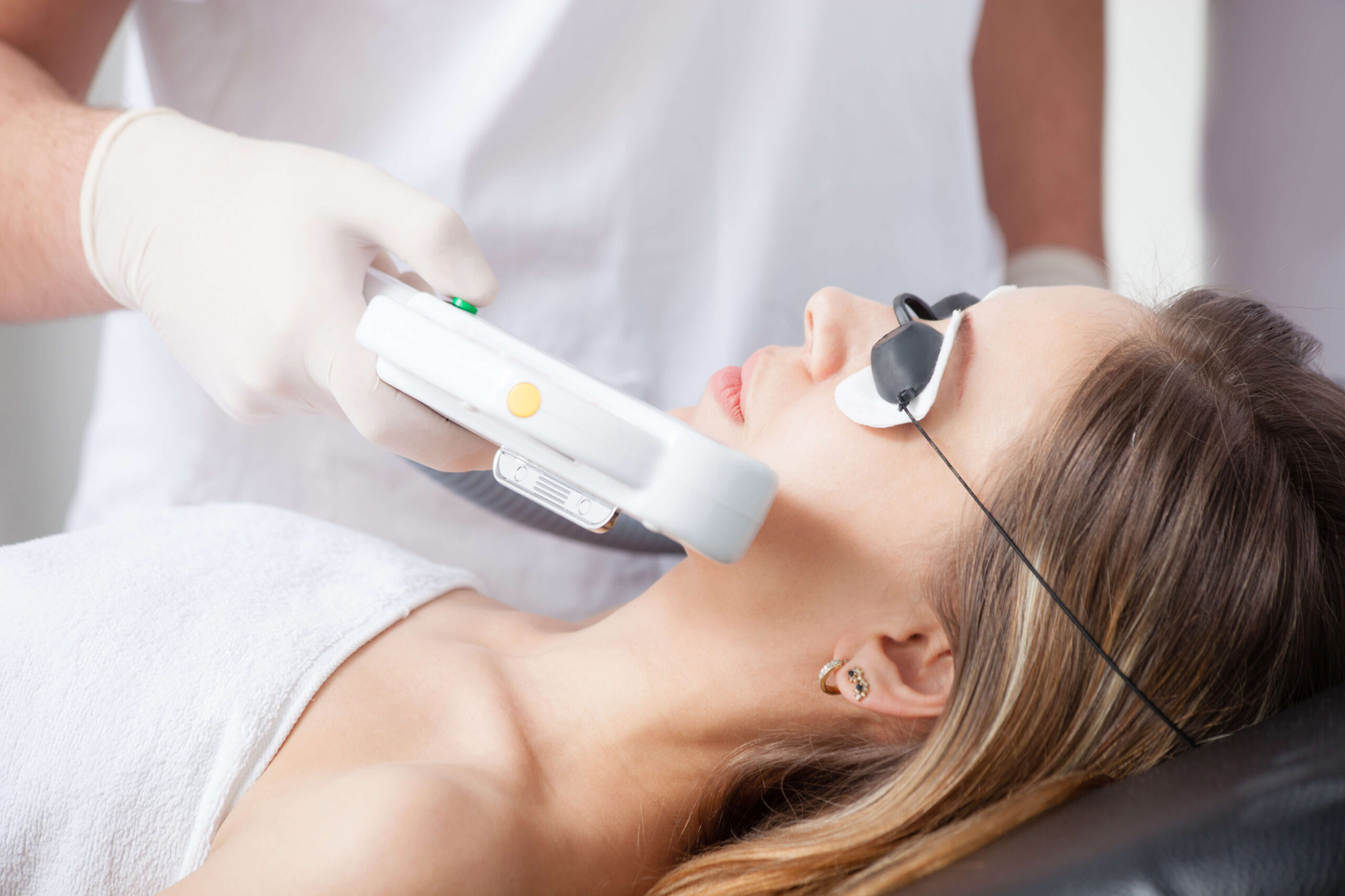 photofacial