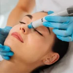 Achieve Youthful Skin: The Power of Agnes and Secret RF Treatments